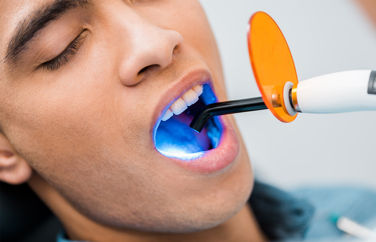 Laser Treatment for Periodontal Pockets in Colorado Springs CO Area