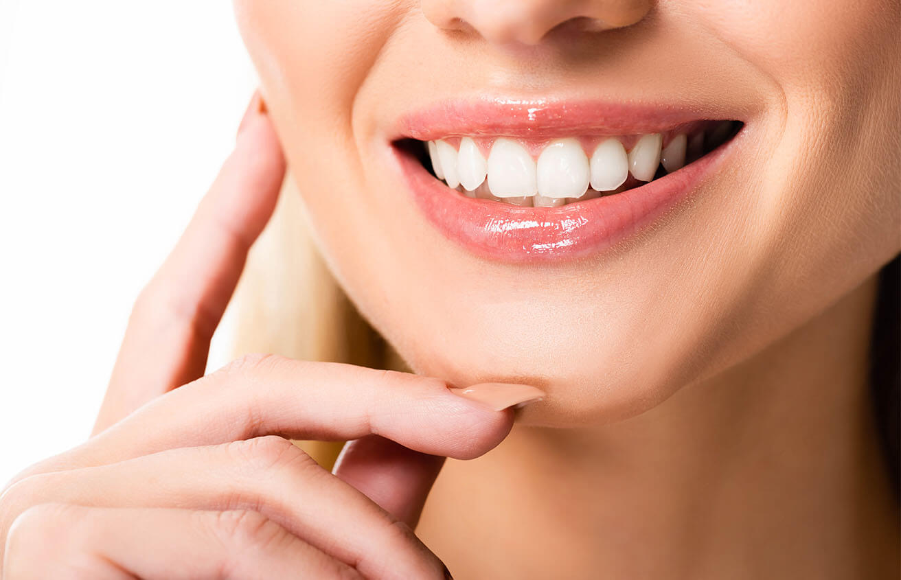 How Long Does Teeth Whitening Last in Colorado Springs CO Area