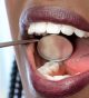 What should I do when diagnosed with periodontal gum pockets by my dentist?