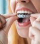 Do I need SureSmile aligners or traditional metal braces?